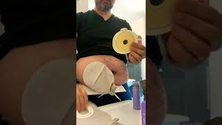 Soins d’une Stomie digestive en 5 minutes ostomy care in less than 5mn [upl. by Leuneb659]