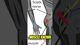 Physical Therapy Not Helping Sciatica Heres One Reason Why [upl. by Nilson475]