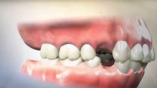 Removing Teeth for Braces  Why Extracting and Retracting Orthodontics is harmful [upl. by Merrick]