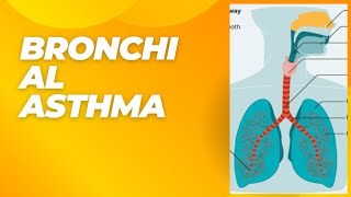 TOPIC15quotBRONCHIAL ASTHMA ITS SYMPTOMS DIAGNOSIS AND TREATMENT [upl. by Rust521]