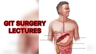 GIT SURGERY LECTURES Peritonitis very imp  types of peritonitis surgerylectures peritonitis [upl. by Sihtnyc]