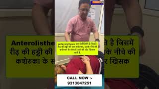 Anterolisthesis  Chiropractic Treatment in Delhi  Dr Varun  Call  9313047251 delhi noida [upl. by Olia]