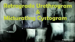 RGU MCU Retrograde Urethrogram and Micturating Cystogram Case Interpretation [upl. by Elag]