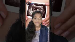 Anamoly Scan Importance in Tamil  shortsviral pregnancy momlifewowlife [upl. by Elag]