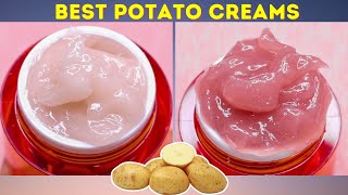 3 Types of Potato Cream to remove pigmentation dark spots acne scars  7 Days Skin Transformation [upl. by Eet617]