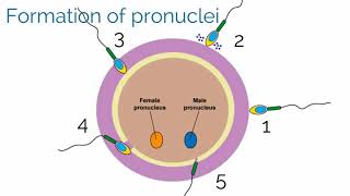 Preeclampsia amp eclampsia  causes symptoms diagnosis treatment pathology [upl. by Laufer]