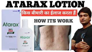 atarax anti itch lotion why doctor is suggesting and how its work and its use [upl. by Erdnassak]