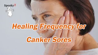 Healing Frequency for Canker Sores – Spooky2 Rife Frequency Healing [upl. by Manard]