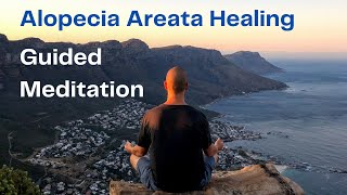 Alopecia Areata Healing Meditation [upl. by Netsryk]