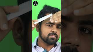 Best Hair Transplant in Udaipur I Udaipur Best Hair Transplant udaipurhairtransplant prptherapy [upl. by Seigler423]