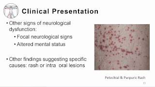 1 Overview meningitis and encephalitis [upl. by Eicnan]