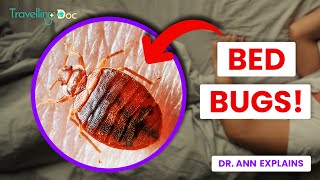 Bedbugs How to Spot and Avoid Them  Doctor Explains [upl. by Erfert922]