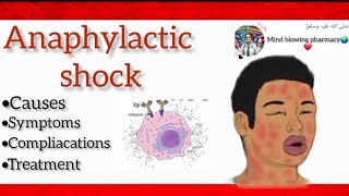 Anaphylactic shockits causessymptoms and treatmentviralvideomedicalmedicineanaphylaxis fyp [upl. by Buschi]