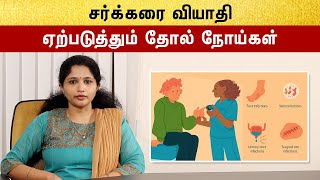 Diabetics Skin Infections Tamil  சர்க்கரை நோயின் அறிகுறிகள் என்ன [upl. by Alliber96]