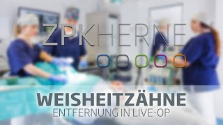 Wie werden Weissheitszähne entfernt Live ZahnOP [upl. by Tamer793]