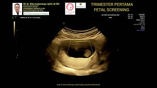 Trimester pertama Fetal Screening 14 weeks [upl. by Nired]