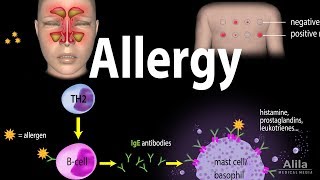 Allergy  Mechanism Symptoms Risk factors Diagnosis Treatment and Prevention Animation [upl. by Audres]