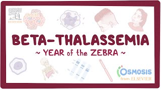 Betathalassemia Year of the Zebra [upl. by Colt]