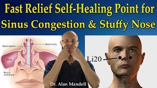 Fast Relief SelfHealing Point for Sinus Congestion Stuffy Nose Headaches  Dr Mandell [upl. by Nnairet693]