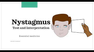 Nystagmus  test and interpretation Essential medicine [upl. by Brenna]