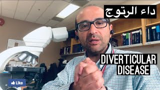 داء الرتوج Diverticular Disease [upl. by Suolekcin]