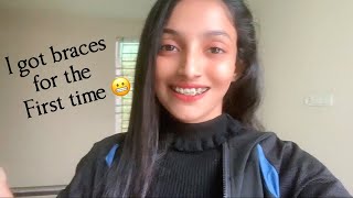 Vlog  I got braces 🥵cost in Bangladesh🇧🇩 [upl. by Liuka]