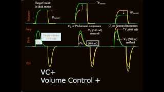 Mechanical ventilation 12 Auto flow English [upl. by Nolrah]