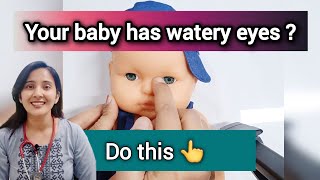 Watering eyes of newborn babies Do this eye massage babycare baby doctor pediatrician [upl. by Ardaid]