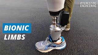 Bionics are the future of prosthetics [upl. by Adniled]