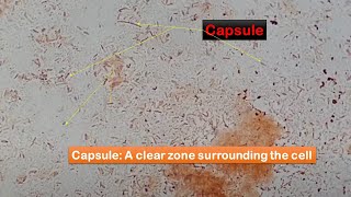 Capsule of bacteria observation in Capsule Stained smears of culture [upl. by Cut383]