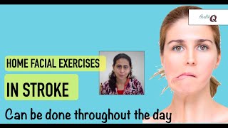 Facial exercises for hemiplegic patient that can be done throughout the day [upl. by Seem]