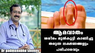 ഈ ലക്ഷണം നിങ്ങൾക്കുണ്ടോ ശ്രദ്ധിക്കുക Dr Padmanabha shenoy RheumatismBaijus Vlogs [upl. by Marci]