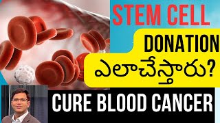 Stem Cell Donation Process Stem Cell Bone MarrowTransplant For Blood Cancer  US Hematologist [upl. by Tnayrb97]