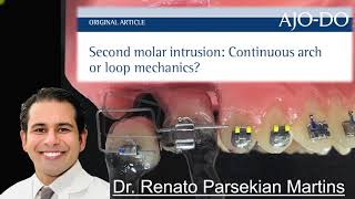 Second Molar Intrusion Continuous Arch or Loop Mechanics [upl. by Ainwat]