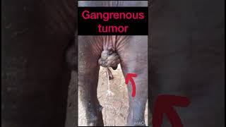 Gangrenous tumor l dr Umar khan [upl. by Remlap]