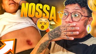 REAGINDO A PIERCING INFLAMADO NO UMBIGO  REACT67 [upl. by Montford]