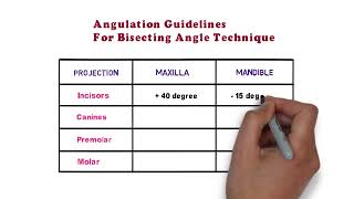 Angulations for IOPA Bisecting Angle technique  RADIOSHOW  Dr Deeksha Sharma [upl. by Ijan]