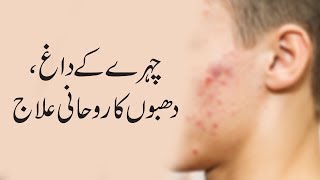 Chehre Ke Dagh Dhabbon Ka Rohani Ilaj  Islamic Spiritual Medicine  Pimples Freckles  Istikhara [upl. by Seravart]