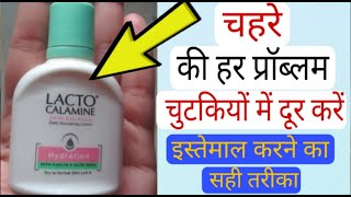 Lacto Calamine Face Lotion Skin Benefitsहिन्दी मैं Calamine lotion Remove Acne Pimples Dark spots [upl. by Rother]