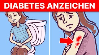 5 akute Anzeichen dafür dass du Diabetes hast [upl. by Leagiba]