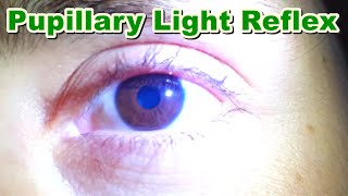 Pupillary Light Reflex  Contraction of Pupil MiosisMyosis  Function  Brain Stem [upl. by Atter]