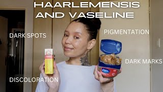 How to treat Dark marks Pigmentation Skin discoloration with Haarlemensis and Vaseline glassskin [upl. by Lonne249]