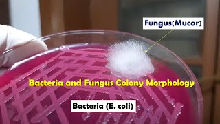 Bacteria and Fungus colony morphology Demonstration [upl. by Canale]