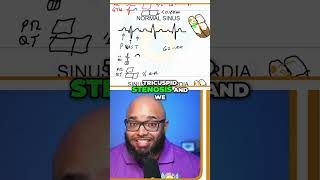 Understanding QRS and P Waves Atrial Hypertrophy Explained [upl. by Airetal]