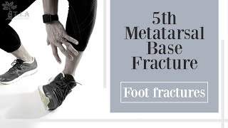 5th Metatarsal Base Fracture Foot [upl. by Quintessa]