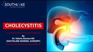 Cholecystitis – Causes Symptoms Treatment and Surgery [upl. by Rodl900]