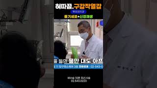 😛혀통증혓바닥 구강작열감증후군💥혀궤양으로 번진 혓바닥 돌기 물 한모금 마실수없는 극한의 혓바닥통증 3차신경 노화했을 때 I 루이빈치과 류지헌 원장 [upl. by Nuahc764]