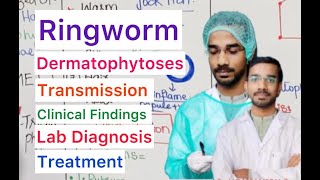 Ringworm  Dermatophytoses  Properties  Clinical  Transmission  Treatment [upl. by Donavon944]