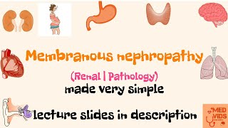 Membranous nephropathy  Renal  Pathology  Med Vids made simple [upl. by Eenafets]