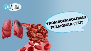 TROMBOEMBOLISMO PULMONAR TEPO QUE É SINTOMAS E PREVENÇÃO [upl. by Ydahs135]